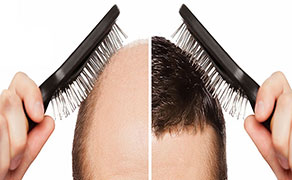 Ücretsiz Analiz Gönder!